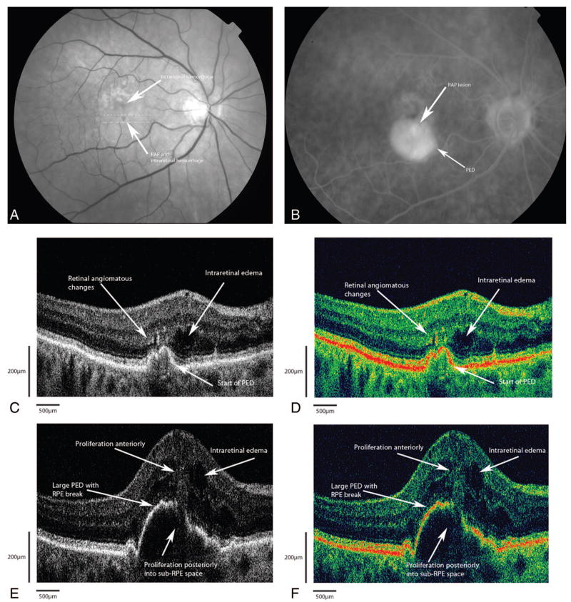 Fig. 3