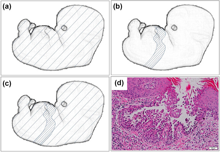 Fig. 1