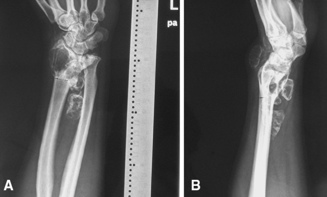 Fig. 1A–B