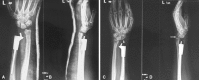 Fig. 4A–D