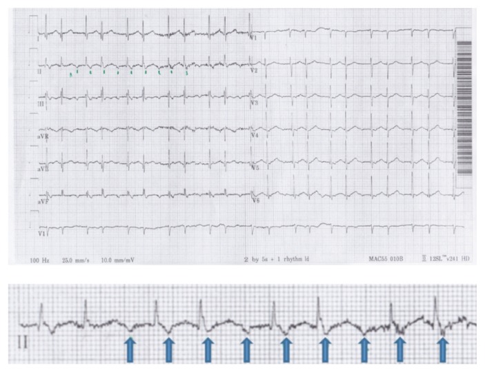 Figure 2: