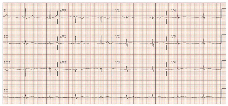 Figure 2: