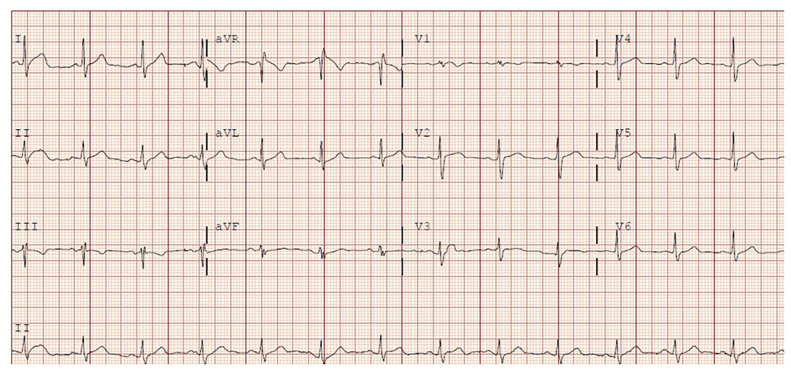 Figure 1: