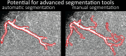 Figure 7—figure supplement 3.