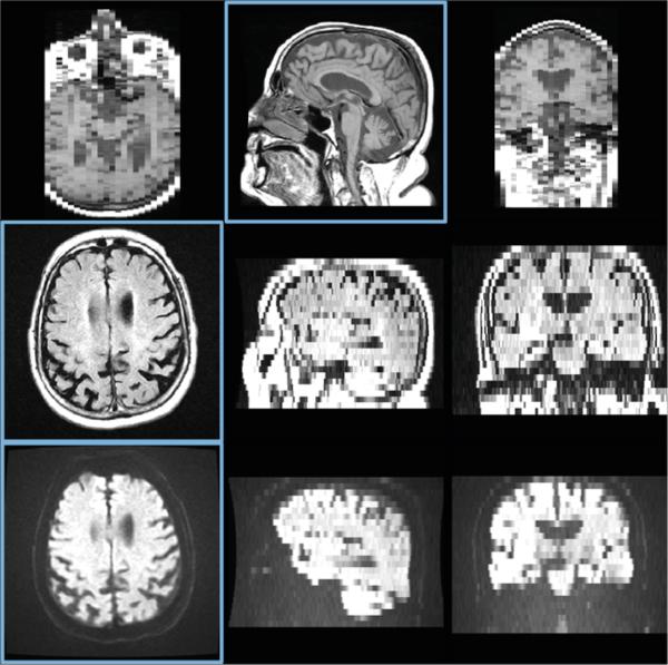 Fig. 1