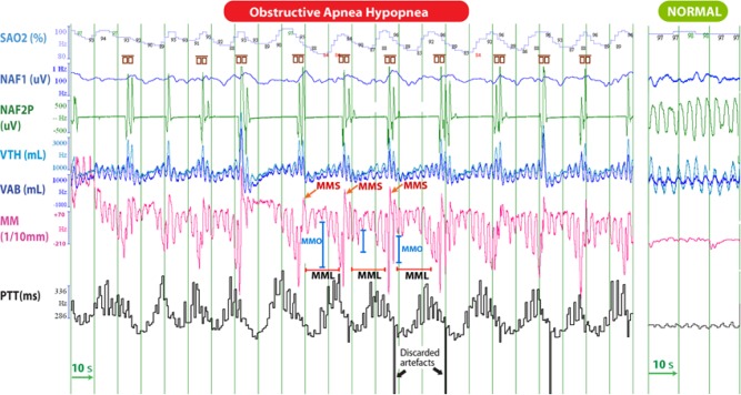 Figure 3A