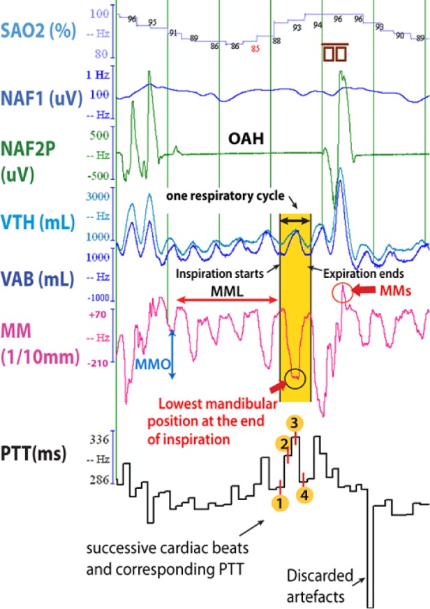 Figure 3B