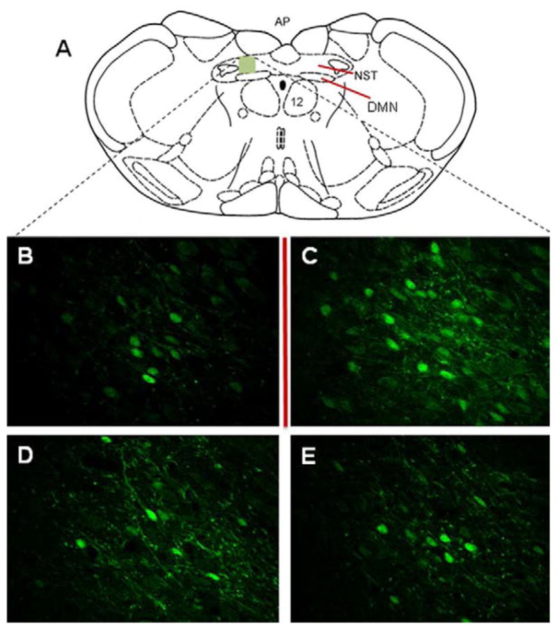 Figure 11