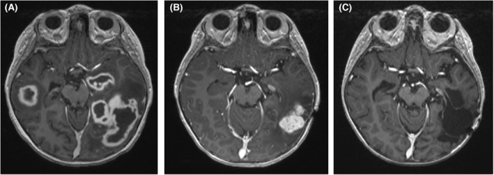 FIGURE 1