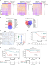 Figure 1. MITF expression is downregulated in advanced lethal prostate cancer patient samples. A, Heat maps of master transcription factor (TF) gene expression in indicated publicly available datasets (GSE35988, GSE3933, and GSE21032). The value in the heat map refers to the color bar. The bar plot shows the signed –log10 P values of the t test by comparing advanced/autopsy to primary prostate cancer. The bar marked in red highlights MITF. B, Venn diagram of upregulated and downregulated master TFs (P < 0.01) among three publicly available datasets. Top 10 commonly deregulated master TFs including at least 2 patient datasets are listed. C, Representative MITF IHC and quantification of MITF-positive cells in morphologically normal prostate glands from prostatectomy specimens, primary prostate cancer, and advanced prostate cancer. PCa, prostate cancer. Scale bar, 100 µm. D, Disease-free survival based on MITF protein expression in a cohort of 52 patients with primary prostate cancer with clinical follow-up. The MITF cutoff point was low ≤20% and high >20% MITF nuclear staining positive cells. E, Disease-free survival based on MITF mRNA expression in patients with primary prostate cancer from two publicly available datasets with clinical follow-up (GSE21032 and https://www.cancer.gov/tcga). The optimal cutoff point was selected automatically using the surv_cutpoint method from the survminer package in R/Bioconductor. TCGA, The Cancer Genome Atlas. *, P < 0.05.