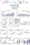 Figure 3. eIF3B is a direct functional effector gene of MITF in prostate cancer. A, Diagram illustrates the experimental workflow used to identify and functionally validate 11 commonly deregulated genes in three MITF-depleted experimental models and two publicly available patient datasets (GSE35988 and GSE21032). RNA-seq, RNA sequencing. B and C, Quantification of colony formation in DU145, 22Rv1, and ARCaPM cells with upregulated (stable shMITF cells; B) and downregulated (shControl cells; C) target genes transfected with control siRNA or two siRNAs targeting each MITF target gene. C, control. D, Pearson correlation analysis between MITF and eIF3B gene expression levels in indicated publicly available clinical prostate cancer datasets (GSE35988 and GSE21032). E, Representative MITF and eIF3B IHC and quantification in prostate cancer tissue samples. The MITF staining was scored as low ≤20% positive nuclei and high >20% positive nuclei, and eIF3B staining intensity was scored as low (− or +) and high (++) in three different areas of each tumor section. χ2 test = Chi-square test. Scale bar, 100 µm. F, Quantification of cell population doubling in DU145, 22Rv1, and ARCaPM cells transfected with empty (EV), MITFA, and/or eIF3B vectors. OE, overexpression. G, MITF ChIP-sequencing profile at the eIF3B locus in 22Rv1 cells. H, Cartoon depicting the five predicted MITF-binding elements (MBE) in the promoter region of eIF3B and ChIP-qPCR of MITF occupancy at MBE1–5 and flanking negative region in the eIF3B promoter of DU145, 22Rv1, and ARCaPM cells. TSS, transcription start site. I, Luciferase eIF3B promoter activity in DU145, 22Rv1, and ARCaPM cells following cotransfection of siRNA control or two siRNAs targeting MITF, or a Renilla transfection control (normalized relative to control siRNA). J, Luciferase eIF3B promoter activity in DU145, 22Rv1, and ARCaPM cells following cotransfection with an empty or MITFA vector, eIF3B promoter luciferase reporter wild-type (WT) or mutated MBE2–3, or a Renilla transfection control. Data, mean ± SD of at least 3 experiments. *, P < 0.05.