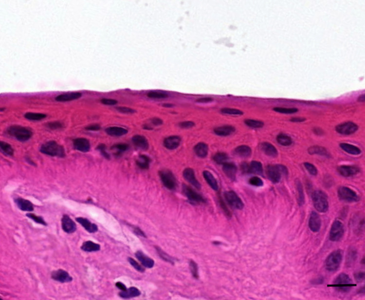 Tape Stripping Method In Dermatological And Pharmacological Research 