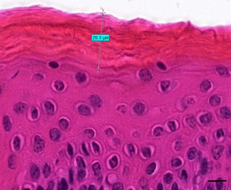 Tape Stripping Method In Dermatological And Pharmacological Research 