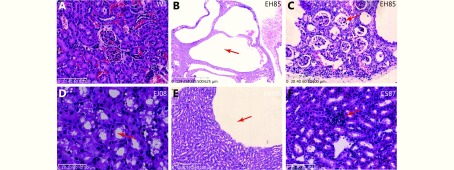 (A) The normal morphology of a kidney from a wild type mouse. (B) An end stage cystic kidney from a G3TM (G3<italic>mTR<sup>-/-</sup>WRN<sup>-/-</sup>p53<sup>S/S</sup></italic>) mouse (ID number: EH85). The normal structure was completely replaced by various sizes of fluid-filled cysts (arrow pointed). (C) Higher magnification power view of the cystic kidney from mouse EH85 showing that the renal tubules and glomeruli were compressed and atrophied. The glomerulus was enclosed and lost its capillary loop structure (arrow pointed). (D) Swelling renal tubule epithelial cells, hydropic degeneration, and vacuolation in the cells were observed (arrow pointed) in the kidney from G3TM mouse EJ08. (E) A kidney from the G3TM mouse EM06, showing the cyst surrounding flat epithelial cells (arrow pointed) that might be caused by fluid pressure changes resulting from cyst formation. (F) An abnormal glomerulus with poorly defined capillary loop (arrow pointed) in the kidney from G3TM mouse CS87.