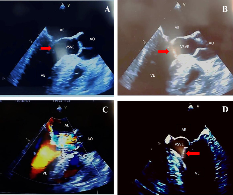 Fig. 1