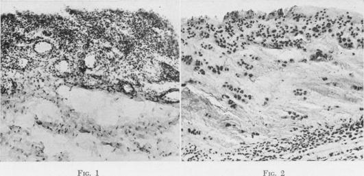 Fig. 1., Fig. 2.