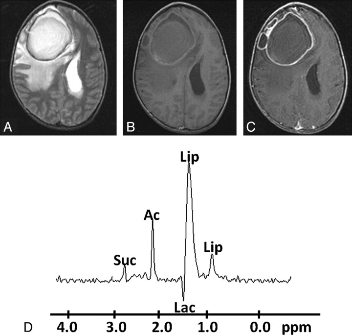 Fig 2.