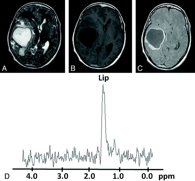 Fig 5.