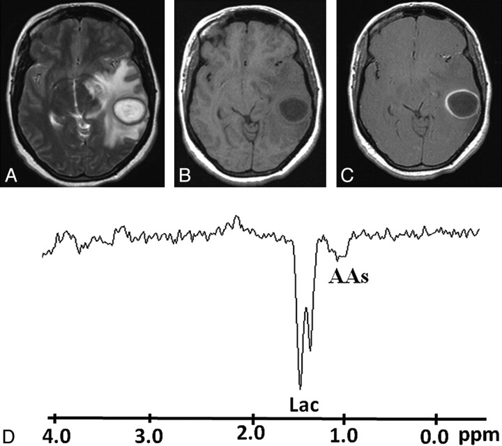 Fig 4.