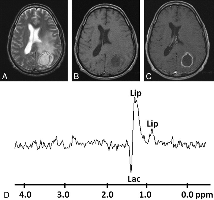 Fig 3.