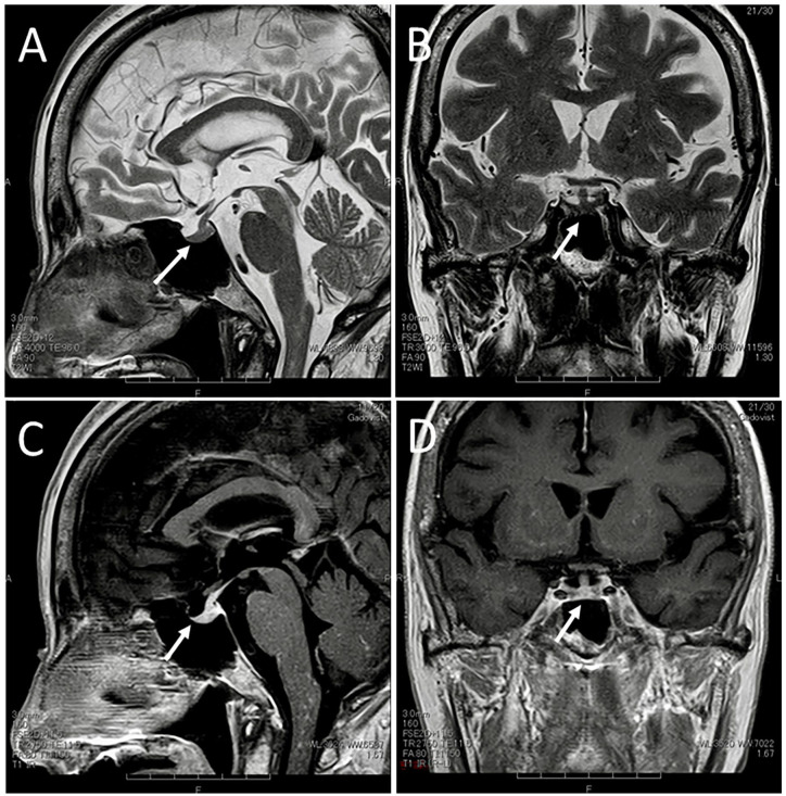 Figure 3.