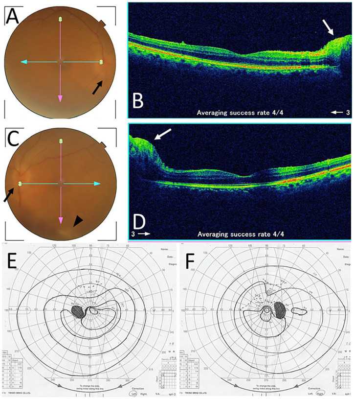 Figure 2.