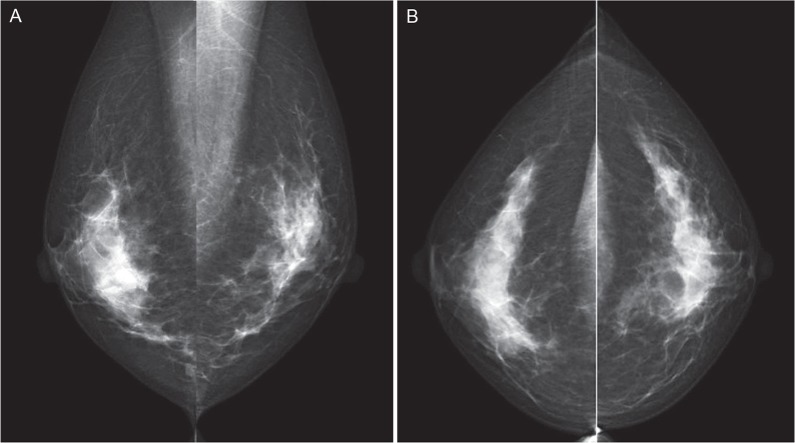 Fig 2.