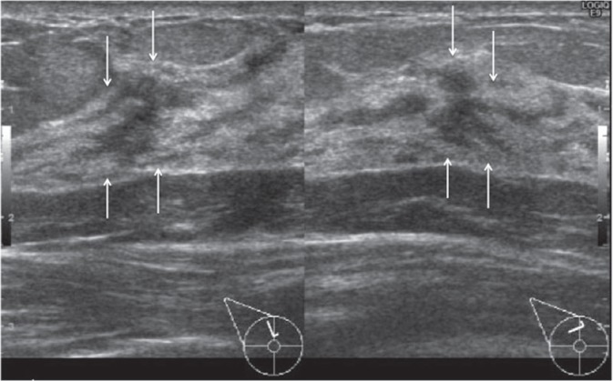 Fig 5.