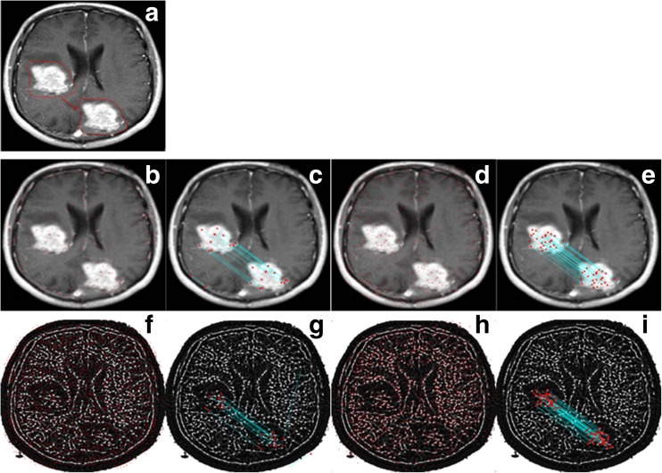 Fig. 12