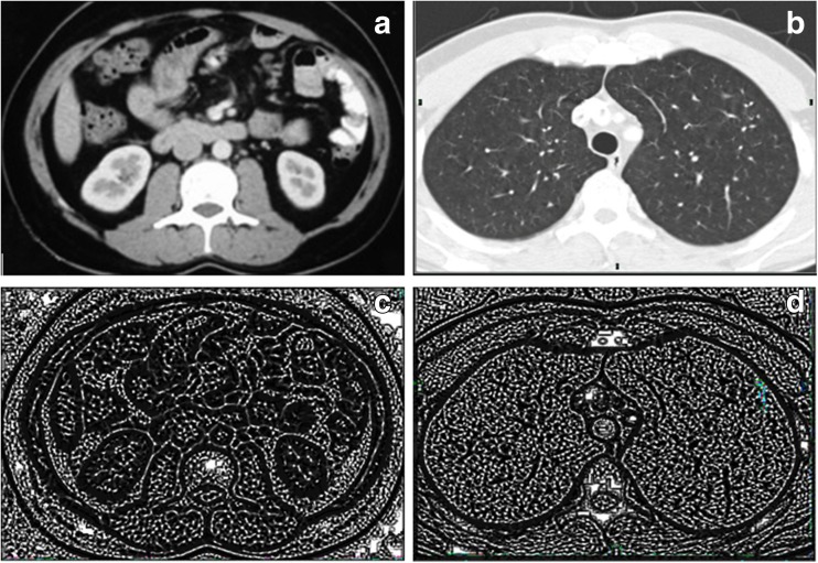 Fig. 14