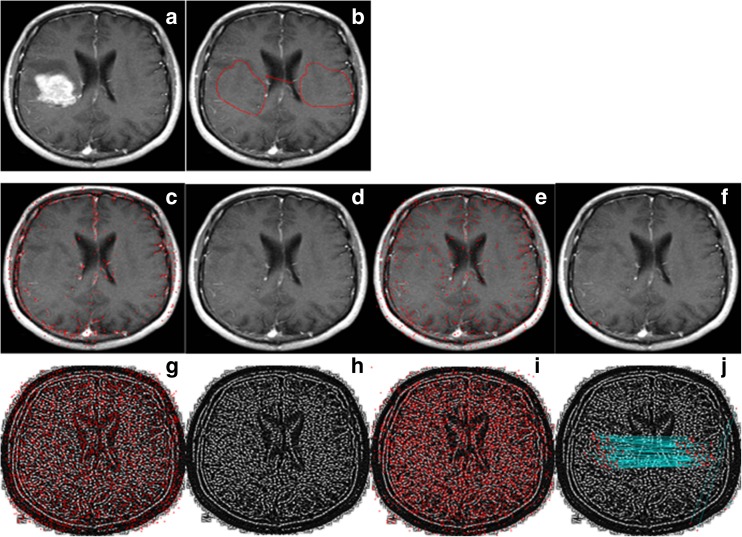 Fig. 10