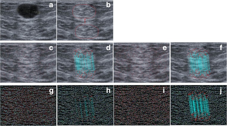 Fig. 13