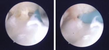 Fig. 13