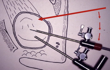 Fig. 11