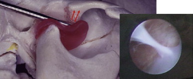 Fig. 4