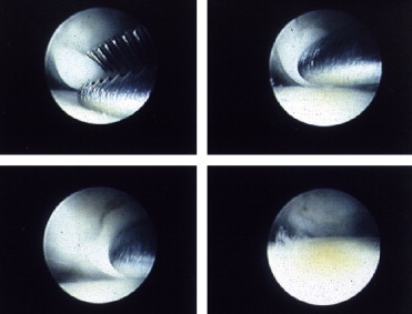 Fig. 12