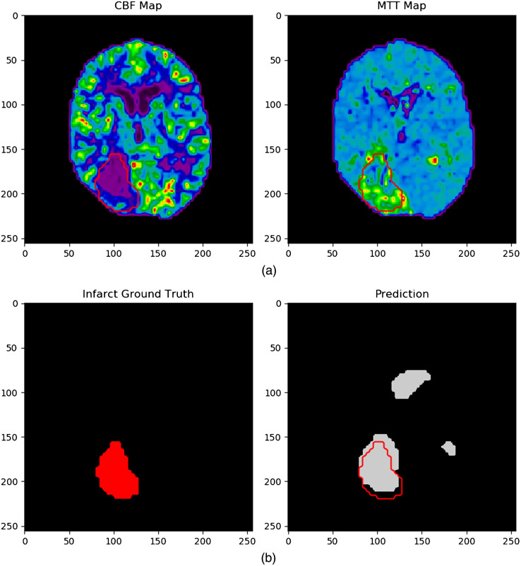 Fig. 12