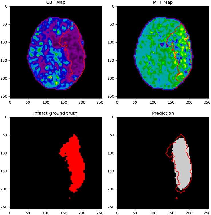 Fig. 11