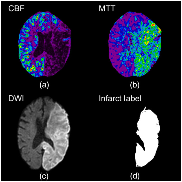 Fig. 6