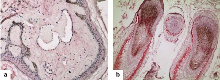 Fig. (1)