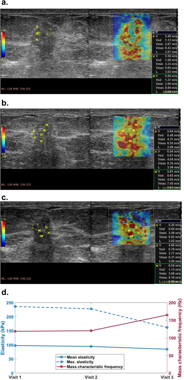 Fig. 4