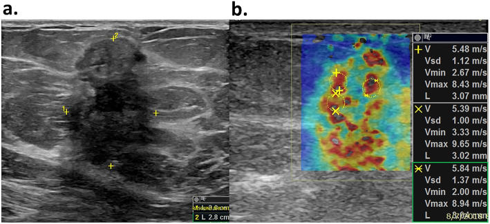 Fig. 2