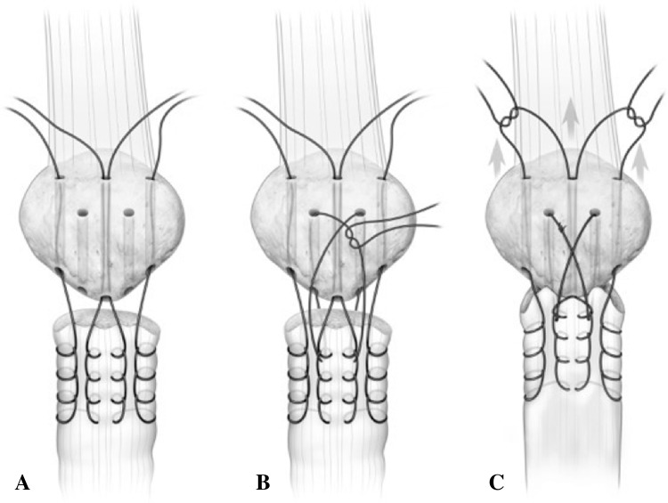 Fig. 2A–C