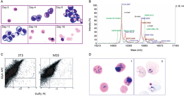 Phenotypic and functional analyses of red blood cells (RBCs) derived from
CD34 + human haematopoietic stem cells (hHSCs) of peripheral blood (PB) and
bone marrow (BM). A: differentiation of hHSCs observed on bright field after
cytospin and staining with Giemsa and Brilliant cresyl blue at the indicated
days. Magnitude 1,000X; B: analysis of haemoglobin by Maldi TOF Mass
Spectrometry [human control RBCs (red), reticulocytes from BM CD34 + cells
(blue), reticulocytes from human umbilical cord CD34 + cells (green)]; C:
flow cytometry analysis of day 14 reticulocytes derived from PB CD34 + hHSCs
and differentiated either with 3T3 or MS5 feeder stromal cells. Cells were
double labelled with antibodies against glycophorin A (GlyA-APC) and Duffy
blood receptor (Duffy-PE); D: Giemsa stained smears of RBCs derived from PB
CD34 + hHSCs infected with Plasmodium falciparum (1) and Plasmodium vivax
(2) after 24 h post infection. 