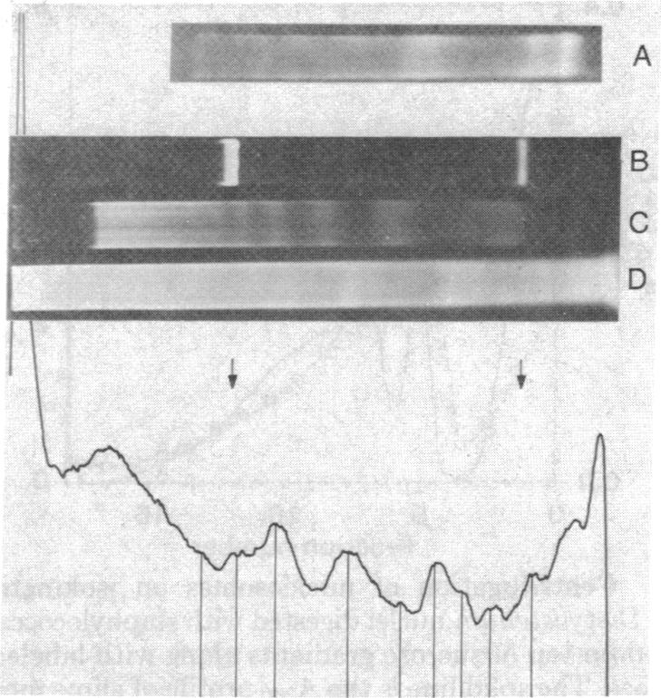 graphic file with name pnas00014-0179-a.jpg