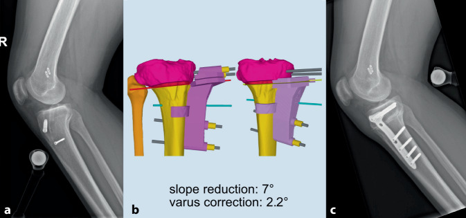 graphic file with name 132_2021_4103_Fig4_HTML.jpg