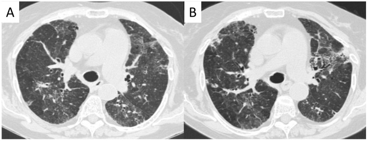 Figure 15