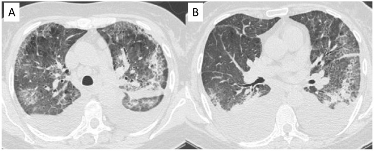 Figure 12