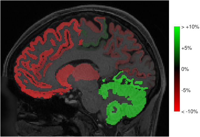 FIGURE 17