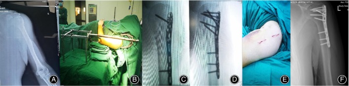 FIGURE 2